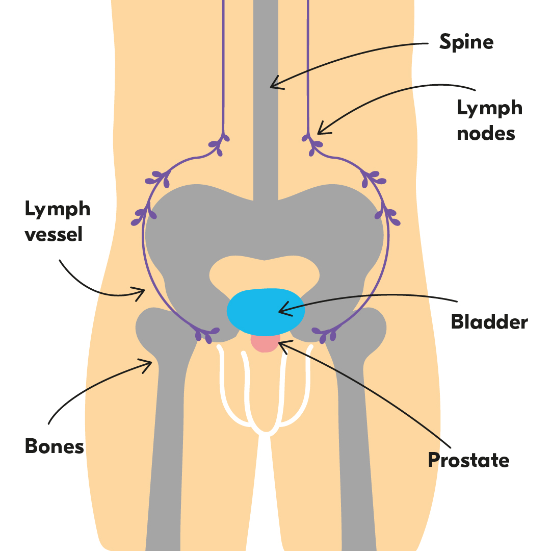About Prostate Cancer - Tackle Prostate Cancer